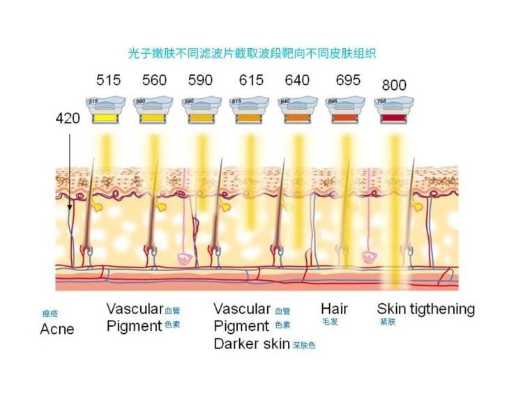 五大光子嫩膚技術(shù)（IPL、DPL、OPT、APT、BBL）及濾光片區(qū)別