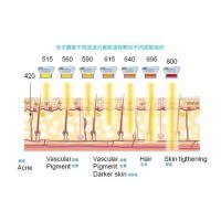 五大光子嫩膚技術(shù)（IPL、DPL、OPT、APT、BBL）及濾光片區(qū)別